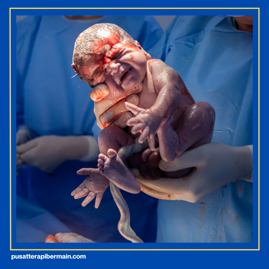 Penyebab Gangguan Sensori Integrasi